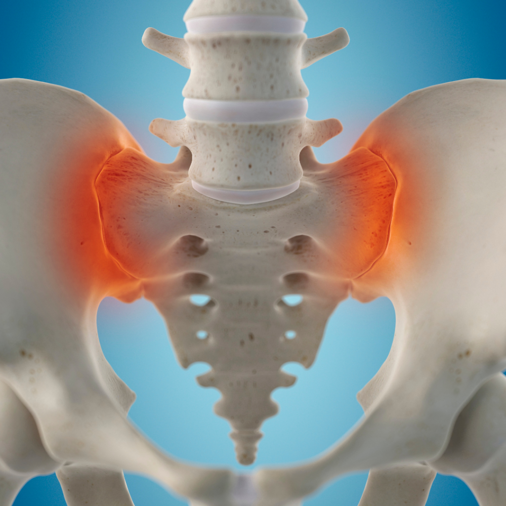 sacroiliac pain relief