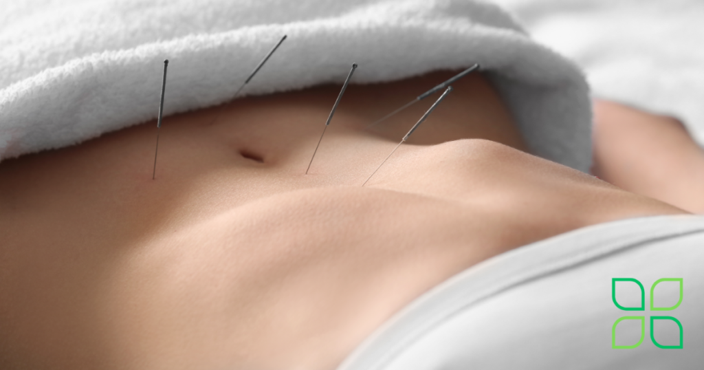 acupuncture for fertility