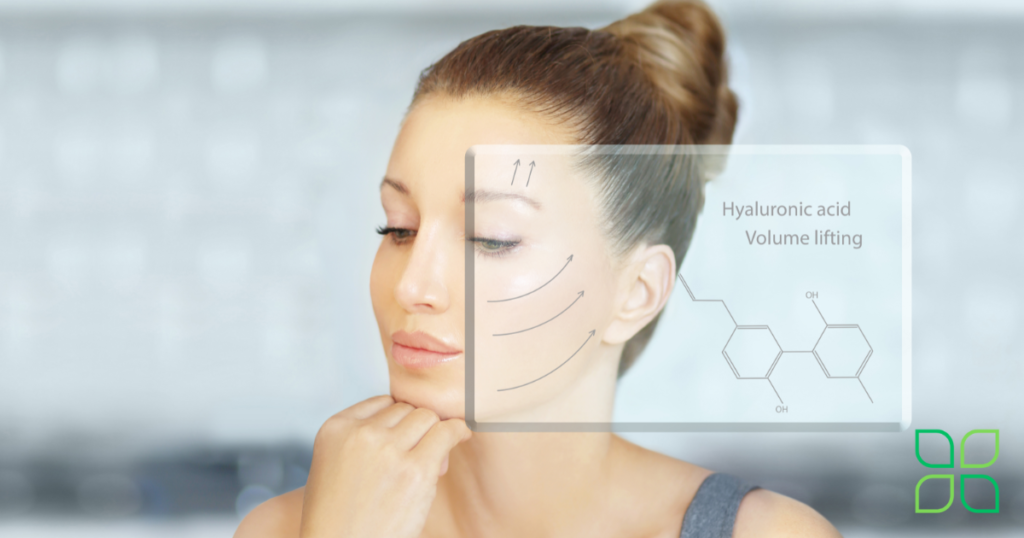 a woman showing how hyaluronic acid gives you a face lift