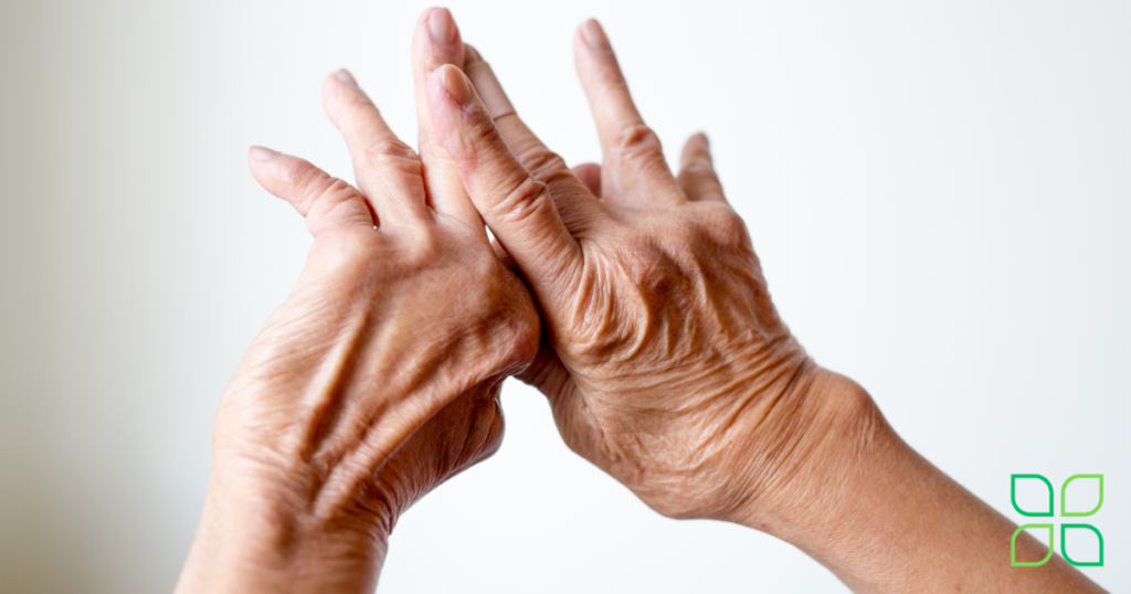 arthritis in hands