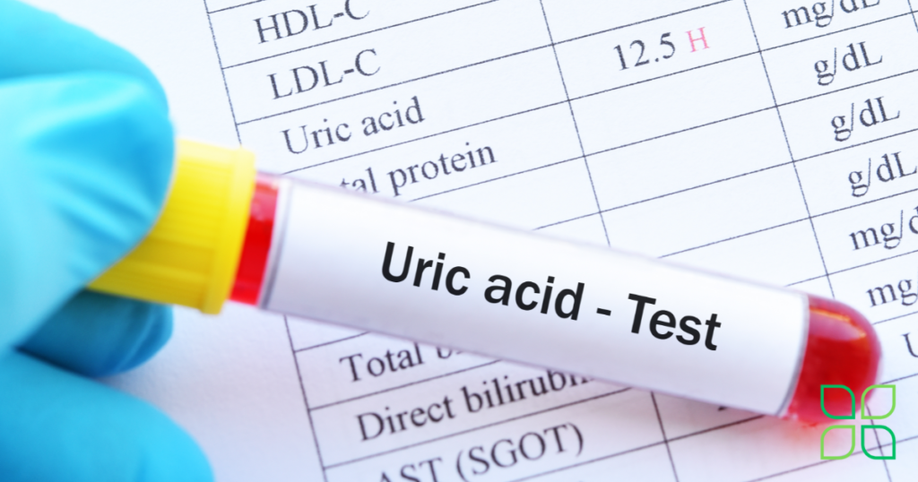 uric acid test for gout